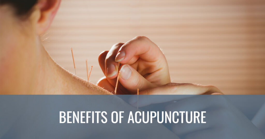 benefits of Acupuncture